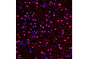 Immunofluorescence of paraffin embedded rat brain using HOXC9 (ABIN7074251) at dilution of 1:650 (400x lens) (HOXC9 antibody)