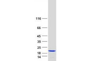 Western Blotting (WB) image for Stathmin 1 (STMN1) (Transcript Variant 2) protein (Myc-DYKDDDDK Tag) (ABIN2732833)