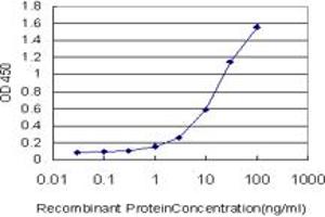 Detection limit for recombinant GST tagged DSE is approximately 0. (DSE antibody  (AA 574-673))