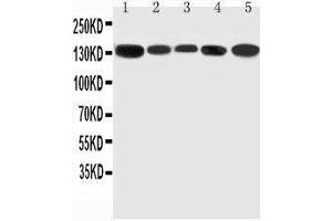 Anti-RGS3 antibody, Western blotting Lane 1: Rat Testis Tissue Lysate Lane 2: Rat Brain Tissue Lysate Lane 3: Rat Spleen Tissue Lysate Lane 4: HELA Cell Lysate Lane 5: U87 Cell Lysate (RGS3 antibody  (C-Term))