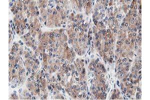 Image no. 6 for anti-Leucine Carboxyl Methyltransferase 1 (LCMT1) antibody (ABIN1499107) (LCMT1 antibody)