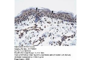 Human Skin (TAF9 antibody  (N-Term))