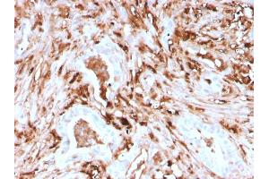 Immunohistochemistry (IHC) image for anti-Ferritin, Light Polypeptide (FTL) (AA 38-165) antibody (ABIN6939462)