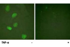 Immunofluorescence analysis of HeLa cells, treated with TNF-a (20 nM, 15 mins), using HDAC3 polyclonal antibody .