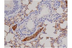 ABIN6267606 at 1/200 staining Mouse lung tissue sections by IHC-P. (FAK antibody  (pTyr576))