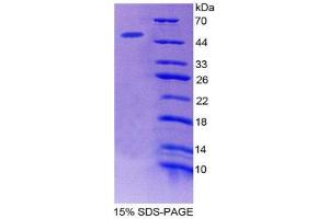 SDS-PAGE (SDS) image for Microfibrillar Associated Protein 2 (MFAP2) (AA 8-171) protein (His tag,GST tag) (ABIN1981101) (MFAP2 Protein (AA 8-171) (His tag,GST tag))