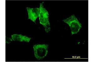 Immunofluorescence of monoclonal antibody to CEL on HeLa cell. (Cholesterol Esterase antibody  (AA 378-477))