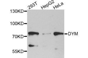 Western blot analysis of extracts of various cell lines, using DYM antibody. (Dymeclin antibody)