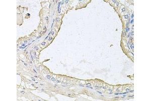 Immunohistochemistry of paraffin-embedded Human prostate using HPR Polyclonal Antibody at dilution of 1:100 (40x lens). (HPR antibody)
