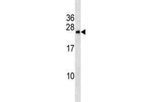 BNIP1 antibody western blot analysis in MCF-7 lysate (BNIP1 antibody  (AA 26-55))