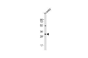 Anti-NBPF12 Antibody (Center)at 1:2000 dilution + human ovary lysates Lysates/proteins at 20 μg per lane. (NBPF12 antibody  (AA 148-181))