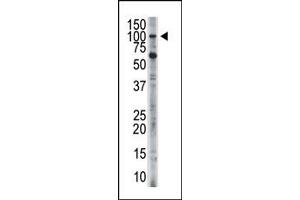 Image no. 1 for anti-Hexokinase 3 (White Cell) (HK3) (C-Term) antibody (ABIN360637) (HK3 antibody  (C-Term))