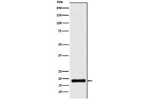 Western blot analysis of UBE2B expression in Jurkat cell lysate.