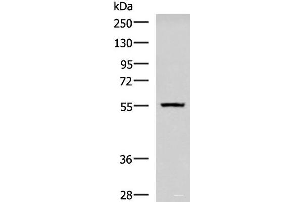 CAMKK1 antibody