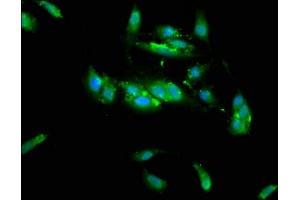 Immunofluorescence staining of Hela cells with ABIN7173439 at 1:133, counter-stained with DAPI. (TRIM35 antibody  (AA 1-206))