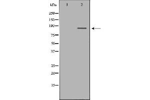 Western blot analysis of 293T whole cell lysates, using OCA2 Antibody.
