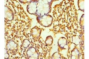 Immunohistochemistry of paraffin-embedded human small intestine tissue using ABIN7167346 at dilution of 1:100 (Rab4 antibody  (AA 1-218))