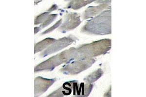 Formalin-fixed and paraffin-embedded human skeletal muscle tissue reacted with PIK3CG polyclonal antibody  , which was peroxidase-conjugated to the secondary antibody, followed by DAB staining. (PIK3 gamma antibody  (Internal Region))