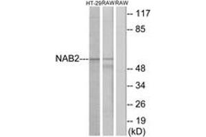Western blot analysis of extracts from HT-29/RAW264. (NAB2 antibody  (AA 261-310))