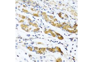 Immunohistochemistry of paraffin-embedded human stomach using OGN antibody (ABIN6131952, ABIN6145008, ABIN6145009 and ABIN6222384) at dilution of 1:100 (40x lens). (OGN antibody  (AA 20-298))