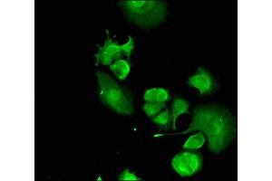 Immunofluorescent analysis of MCF-7 cells using ABIN7152544 at dilution of 1:100 and Alexa Fluor 488-congugated AffiniPure Goat Anti-Rabbit IgG(H+L) (FANCC antibody  (AA 1-210))