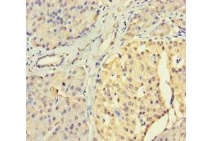 Immunohistochemistry of paraffin-embedded human pancreatic tissue using ABIN7174304 at dilution of 1:100
