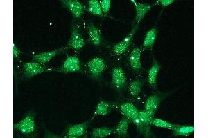 Immunofluorescence (IF) image for anti-Tumor Protein P53 (TP53) (C-Term) antibody (ABIN870299) (p53 antibody  (C-Term))
