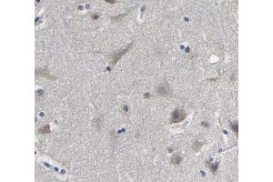 ABIN6269111 at 1/200 staining human brain tissue sections by IHC-P.