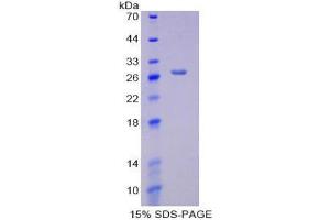 SDS-PAGE (SDS) image for Creatine Kinase, Mitochondrial 1A (CKMT1A) (AA 41-250) protein (His tag) (ABIN2124512)