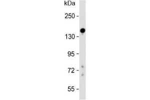 Western blot testing of human liver lysate with Lubricin antibody at 1:500. (Proteoglycan 4 antibody  (AA 176-210))