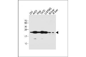 All lanes : Anti-RAB1B Antibody (C-term) at 1:1000 dilution Lane 1: 293 whole cell lysate Lane 2: A431 whole cell lysate Lane 3: Hela whole cell lysate Lane 4: T47D whole cell lysate Lane 5: U-87MG whole cell lysate Lane 6: Mouse liver lysate Lane 7: Rat liver lysate Lysates/proteins at 20 μg per lane. (RAB1B antibody  (C-Term))