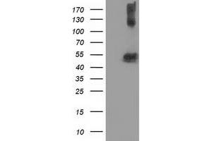 HEK293T cells were transfected with the pCMV6-ENTRY control (Left lane) or pCMV6-ENTRY TUBB4 (Right lane) cDNA for 48 hrs and lysed. (TUBB4 antibody)