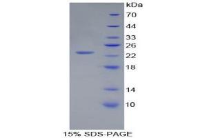 SDS-PAGE (SDS) image for Peptidoglycan Recognition Protein 1 (PGLYRP1) (AA 18-183) protein (His tag) (ABIN1879809) (PGLYRP1 Protein (AA 18-183) (His tag))