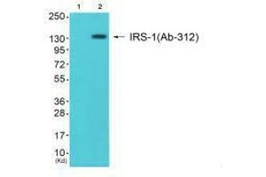 Western blot analysis of extracts from JK cells (Lane 2), using IRS-1 (Ab-312) antiobdy. (IRS1 antibody  (Ser312))