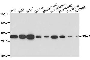 Western blot analysis of extracts of various cell lines, using SNAI1 antibody. (SNAIL antibody)