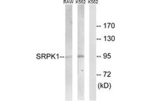 Western Blotting (WB) image for anti-SRSF Protein Kinase 1 (SRPK1) (AA 521-570) antibody (ABIN2890620) (SRPK1 antibody  (AA 521-570))