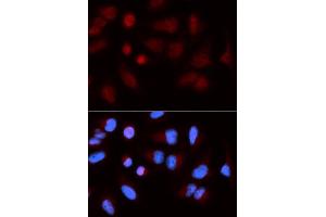 Immunofluorescence (IF) image for anti-SH2B Adaptor Protein 1 (SH2B1) antibody (ABIN1876744) (SH2B1 antibody)