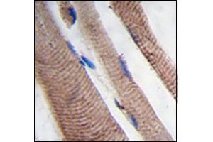 Formalin-fixed and paraffin-embedded human skeletal muscle tissue reacted with PI3KC3 Antibody , which was peroxidase-conjugated to the secondary antibody, followed by DAB staining. (PIK3C3 antibody  (AA 19-49))