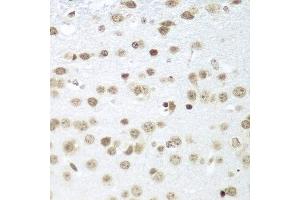 Immunohistochemistry of paraffin-embedded mouse brain using SAP18 antibody at dilution of 1:100 (40x lens).