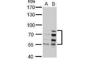 WB Image Lamin A + C antibody detects Lamin A + C protein by Western blot analysis. (Lamin A/C antibody)