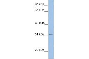 WB Suggested Anti-ECHDC2 Antibody Titration:  0.