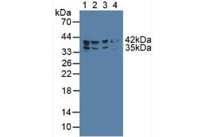 Figure. (FADS2 antibody  (AA 1-130))