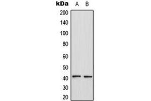 Western blot analysis of CCR4 expression in HL60 (A), MCF7 (B) whole cell lysates. (CCR4 antibody  (Center))