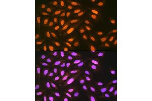 Immunofluorescence analysis of U-2 OS cells using eIF4 Rabbit mAb (ABIN7267047) at dilution of 1:100 (40x lens). (EIF4A3 antibody)