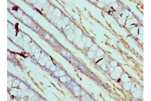 Immunohistochemistry of paraffin-embedded human colon tissue using ABIN7146544 at dilution of 1:100 (Calpain 3 antibody  (AA 582-821))