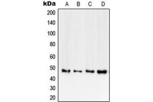 Western blot analysis of CD120b expression in HEK293T (A), mouse heart (B), rat heart (C), PC12 (D) whole cell lysates. (TNFRSF1B antibody  (C-Term))