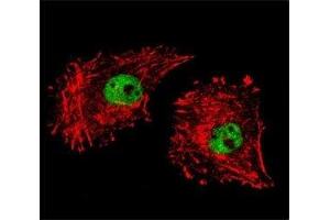 Confocal immunofluorescent analysis of FUS antibody with MDA-MB231 cells followed by Alexa Fluor 488-conjugated goat anti-rabbit lgG (green). (FUS antibody  (AA 499-526))
