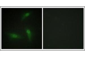 Immunofluorescence analysis of HeLa cells, using hnRNP A1 Antibody.