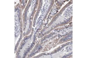 Immunohistochemical staining of human duodenum with PPRC1 polyclonal antibody  shows moderate cytoplasmic positivity in glandular cells at 1:500-1:1000 dilution.