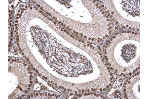 IHC-P Image FUBP1 antibody detects FUBP1 protein at nucleus on mouse testis by immunohistochemical analysis.